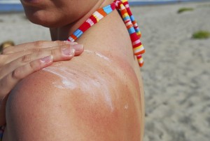 sun burns and soft water